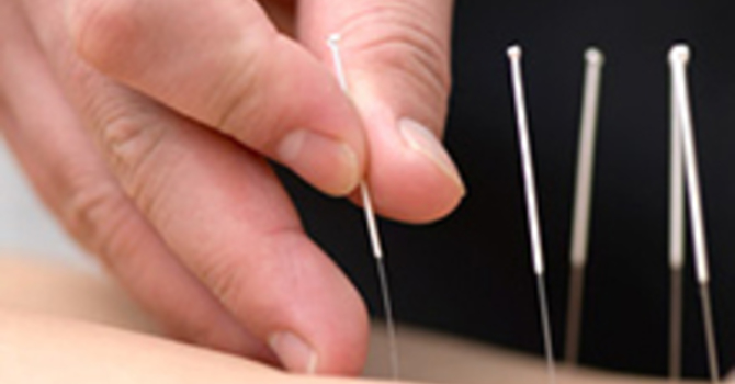 Contemporary Medical Acupuncture and Functional Dry Needling